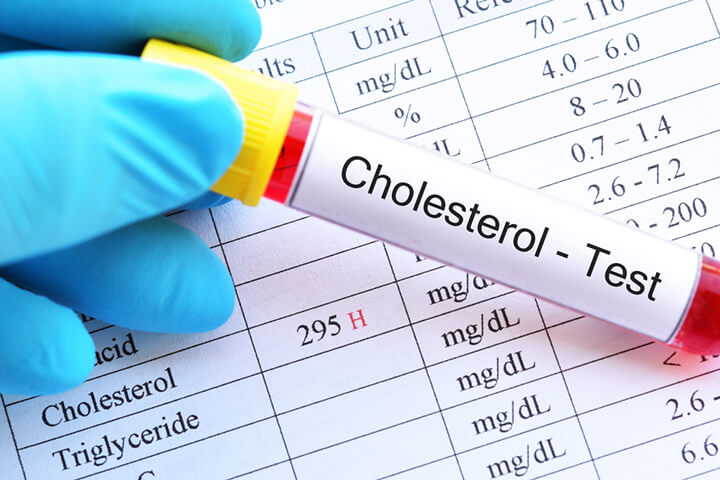 chi so cholesterol trong mau